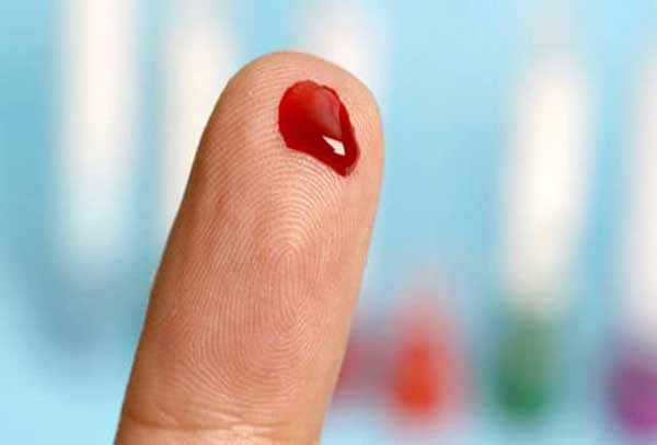 تعبیر خواب دست های خونی + حضرت یوسف و خون دماغ شدن از نظر امام صادق