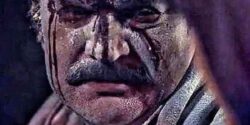 تعبیر خواب صورت زخمی زن + صورت زخمی خودم و زخم صورت دیگران