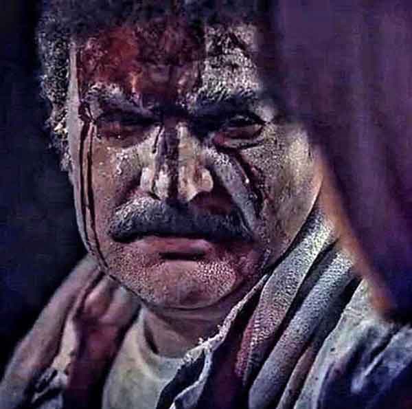 تعبیر خواب صورت زخمی خودم تعبیر خواب زخم صورت دیگران تعبیر خواب صورت زخمی همسر تعبیر خواب صورت زخمی مرده تعبیر خواب زخم صورت دختر مجرد تعبیر خواب زخمی شدن فرزند پسر تعبیر خواب زخمی شدن فرزند دختر تعبیر خواب صورت زخمی پدر