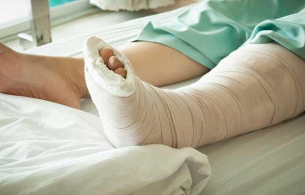 تعبیر خواب شکسته بودن پای مرده + شکستن پا امام صادق و حضرت یوسف