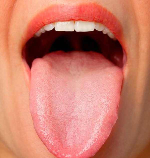 تعبیر خواب جوش زدن زبان + ابن سیرین و امام صادق و جوش چرکی و تاول زدن بدن
