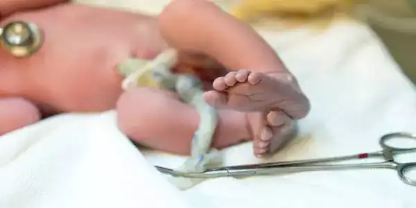 تعبیر خواب زایمان از ناف + بریدن بند ناف نوزاد پسر و ناف برای دختر مجرد