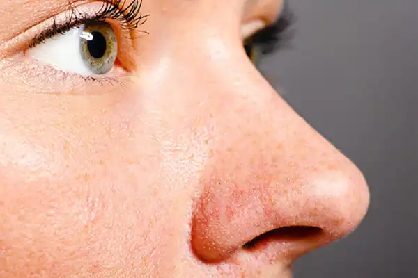 تعبیر خواب بینی کثیف + فضولات بینی و درآوردن دماغ از بینی و دست تو دماغ کردن