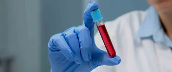 تعبیر خواب رفتن به آزمایشگاه + آزمایش خون ازدواج دختر مجرد و جواب آزمایش بد