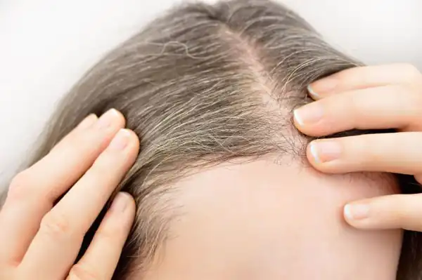 تعبیر خواب سیاه شدن موی سفید زن و دیگران + سیاه شدن موی سفید مرده ابن سیرین
