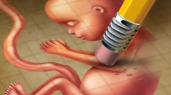 تعبیر خواب سقط جنین زن باردار + از دید ابن سیرین و امام صادق و حضرت یوسف