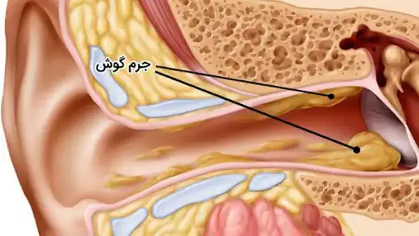 تعبیر خواب آشغال در گوش + برای زن متاهل و باردار و دختر مجرد و از دید مولف