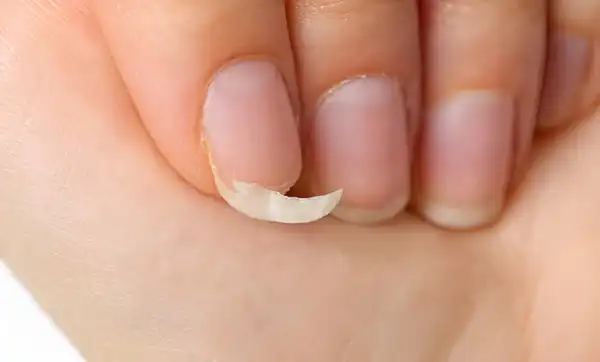 تعبیر خواب ناخن شکسته + معنی ناخن شکسته در خواب های ما چیست